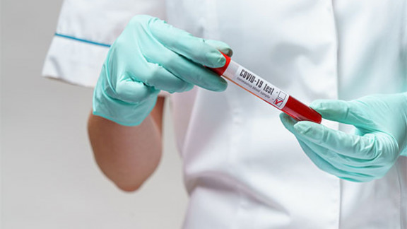 Proroga prestazioni per Covid 19